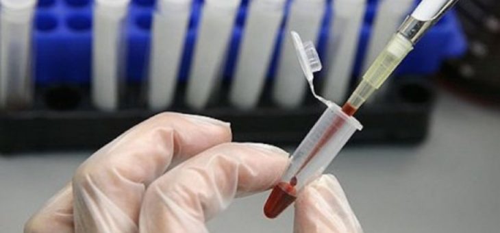 Биомаркер за сърдечносъдов риск